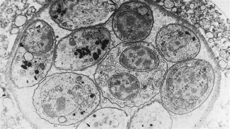  Toxoplasma gondii: ¡Un huésped invisible que manipula mentes!